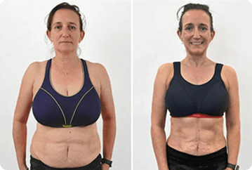 Lana R. ShapeON review